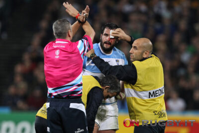 Concussion: dall'Emisfero Sud arriva un nuovo modo per accertarle